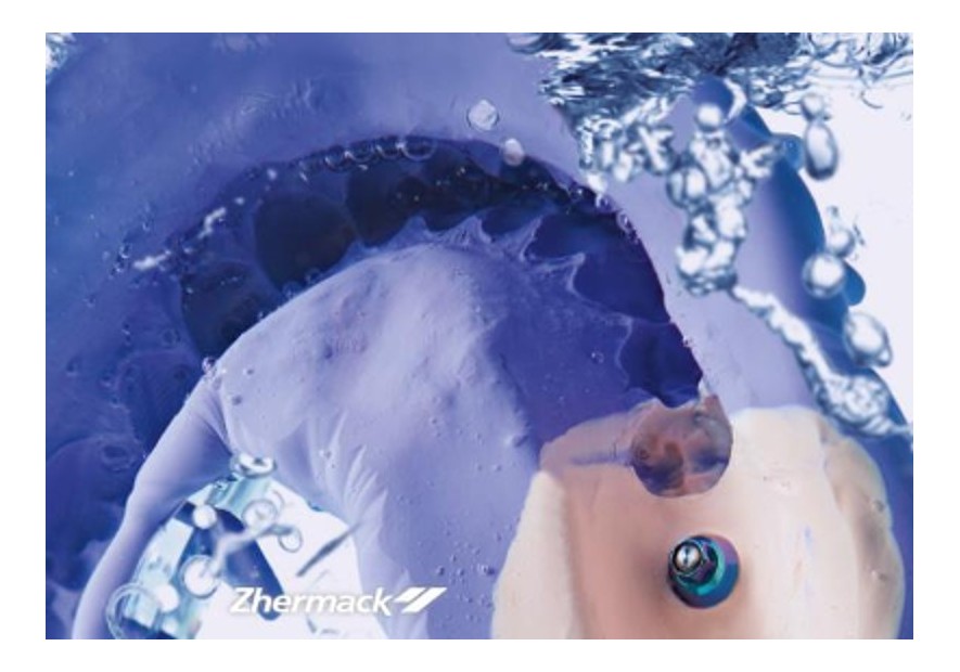 Hydrorise Implant